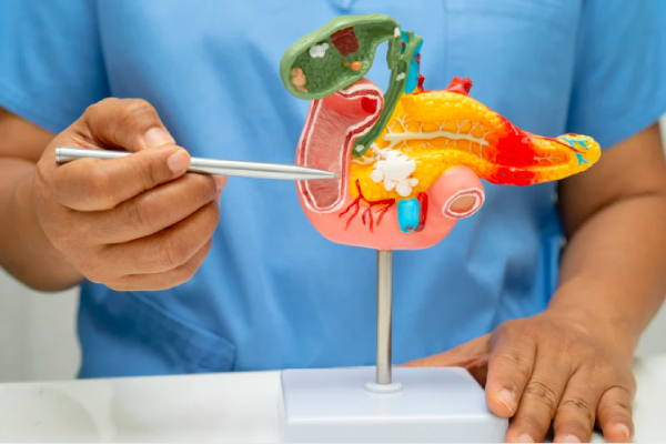 Best Gallstone Treatment in Bharatpur