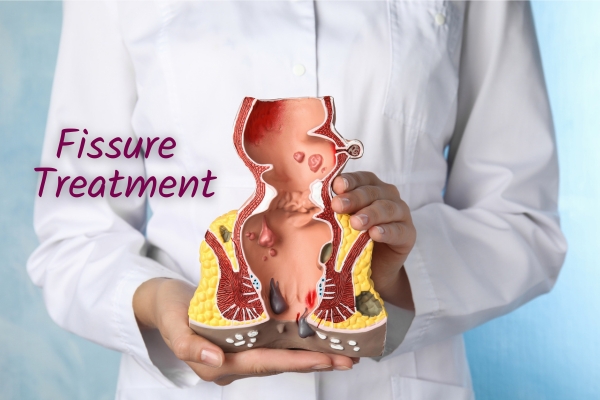 Fissure Doctor in Bharatpur