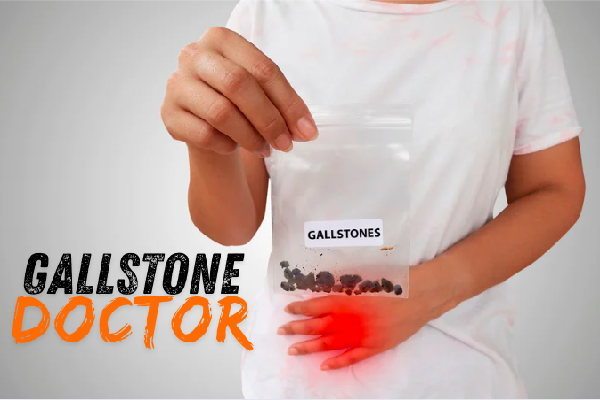 Gallstone Doctor-in Bharatpur